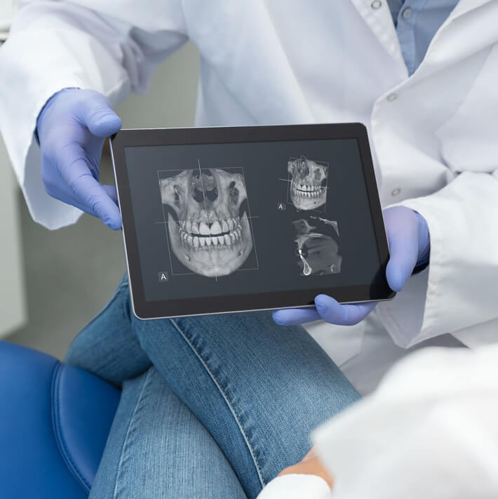 Dental X-Ray Analysis on Tablet